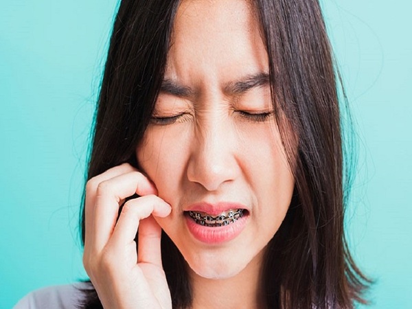 Một số hạn chế của việc niềng răng - Có nên niềng răng không?