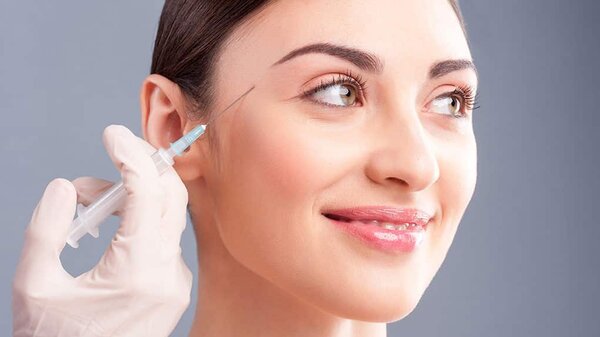 Tiêm filler thái dương giúp giảm hóp thái dương khi niềng răng