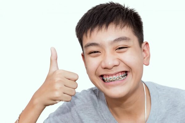 Yếu tố tác động đến thời gian đeo hàm duy trì