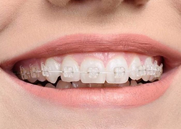 Hoàn tất điều trị