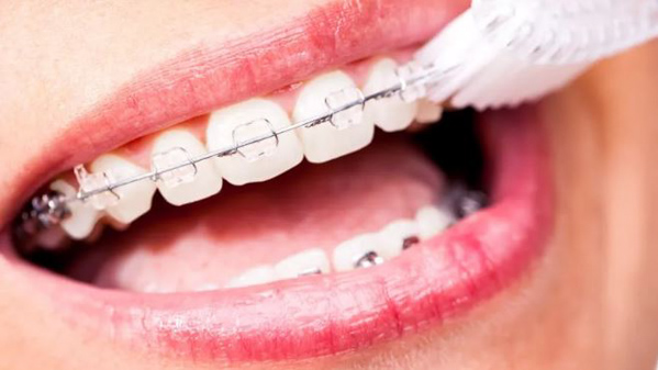 Vệ sinh răng miệng sạch sẽ Vệ sinh răng miệng sạch sẽ