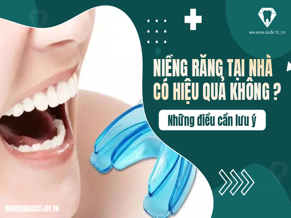 Niềng răng tại nhà có hiệu quả không? Dụng cụ niềng răng tại nhà là gì? Niềng răng tại nhà có hiệu quả không? Dụng cụ niềng răng tại nhà là gì?