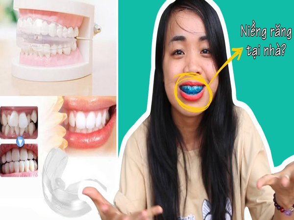Có nên dùng dụng cụ niềng răng tại nhà không? Vì sao? Có nên dùng dụng cụ niềng răng tại nhà không? Vì sao?
