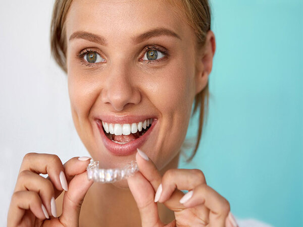 Bộ niềng răng tại nahf cho người lớn Bộ niềng răng tại nahf cho người lớn