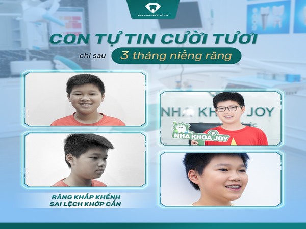 Niềng răng giúp trẻ có nụ cười tự tin hơn