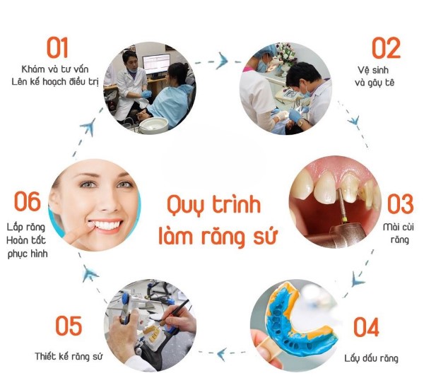 Bao nhiêu tuổi thì bọc răng sứ được? Các bước trong quy trình bọc răng sứ