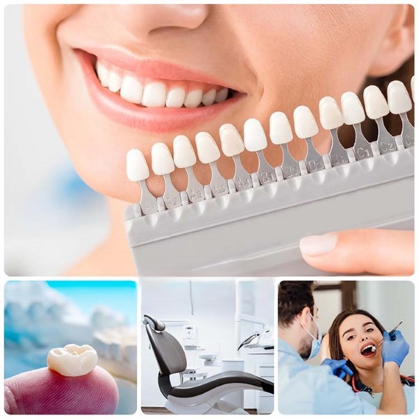 Các tiêu chí lựa chọn nha khoa uy tín để bọc răng sứ