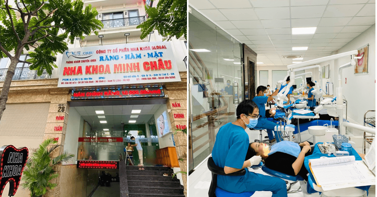 Nha Khoa Minh Châu - Địa chỉ nha khoa uy tín tại Hà Nội bạn nên biết 