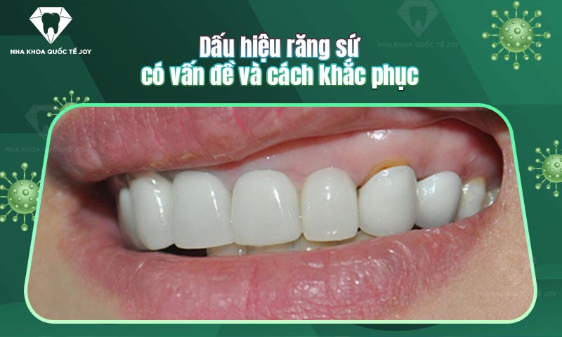 Dấu hiệu răng sứ có vấn đề và cách khắc phục