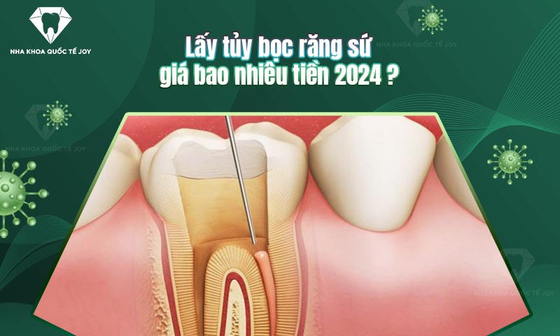 Lấy tủy bọc răng sứ giá bao nhiêu tiền 2024?