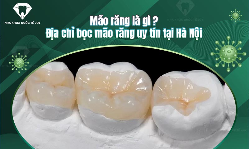Mão răng là gì? Địa chỉ bọc mão răng uy tín tại Hà Nội