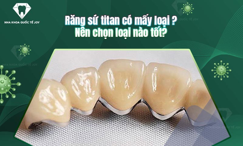 Răng sứ titan có mấy loại? Nên chọn loại nào tốt?