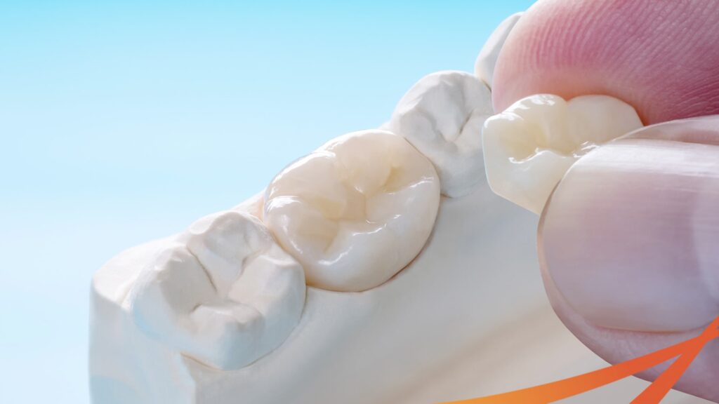 Chăm sóc mão răng sau khi thực hiện