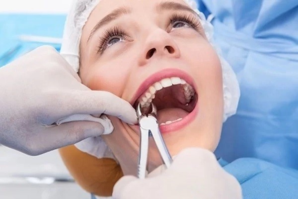 Lựa chọn địa chỉ nhổ răng khôn uy tín