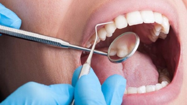 Đến nha khoa để điều trị dứt điểm ê buốt răng