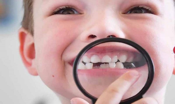 Răng lòi sĩ là gì? Nguyên nhân và giải pháp khắc phục hiệu quả 10 Mất răng gây biến dạng
