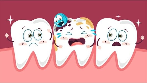 Răng bị sâu lỗ to có trám được không? Những điều cần lưu ý 6 Răng sâu do yếu tố di truyền
